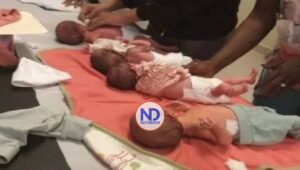 Mujer da a luz cuatrillizos tras meses en hospital dominicano