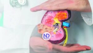 Historia, mitos y avances científicos del trasplante renal