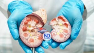 Litiasis Renal, problema frecuente con soluciones innovadoras
