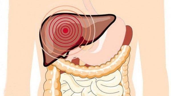 enfermedad de Wilson 1 ¿Qué es la enfermedad de Wilson?