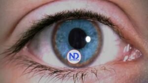 ¿Qué es la enfermedad de Wilson?