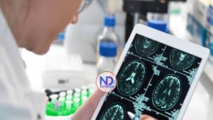 Descubren el ‘punto caliente’ del cerebro donde se produce el envejecimiento