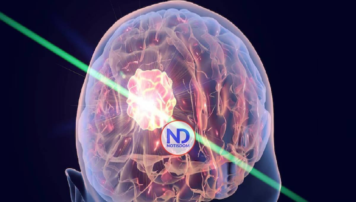 Desarrollan una linterna molecular para detectar metástasis en el cerebro