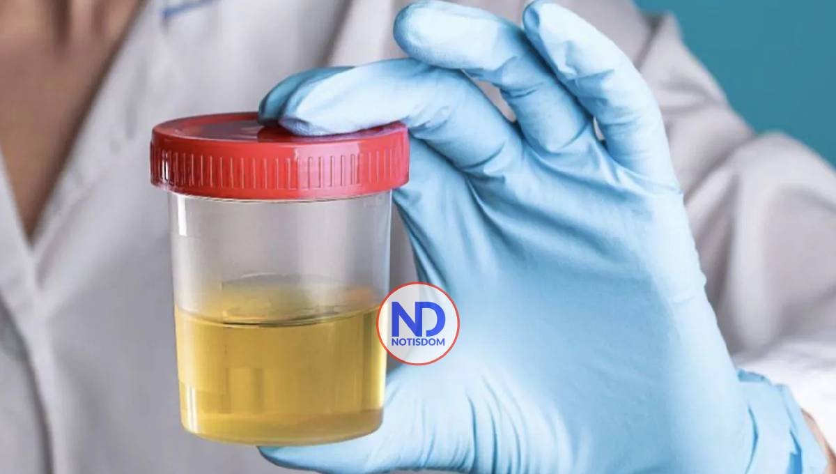 Una prueba de orina casera puede detectar el cáncer de próstata agresivo