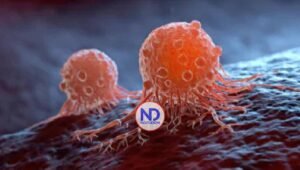 Casos de cáncer van en aumento, ¿cuáles son los desafíos y avances en la lucha contra esta enfermedad?