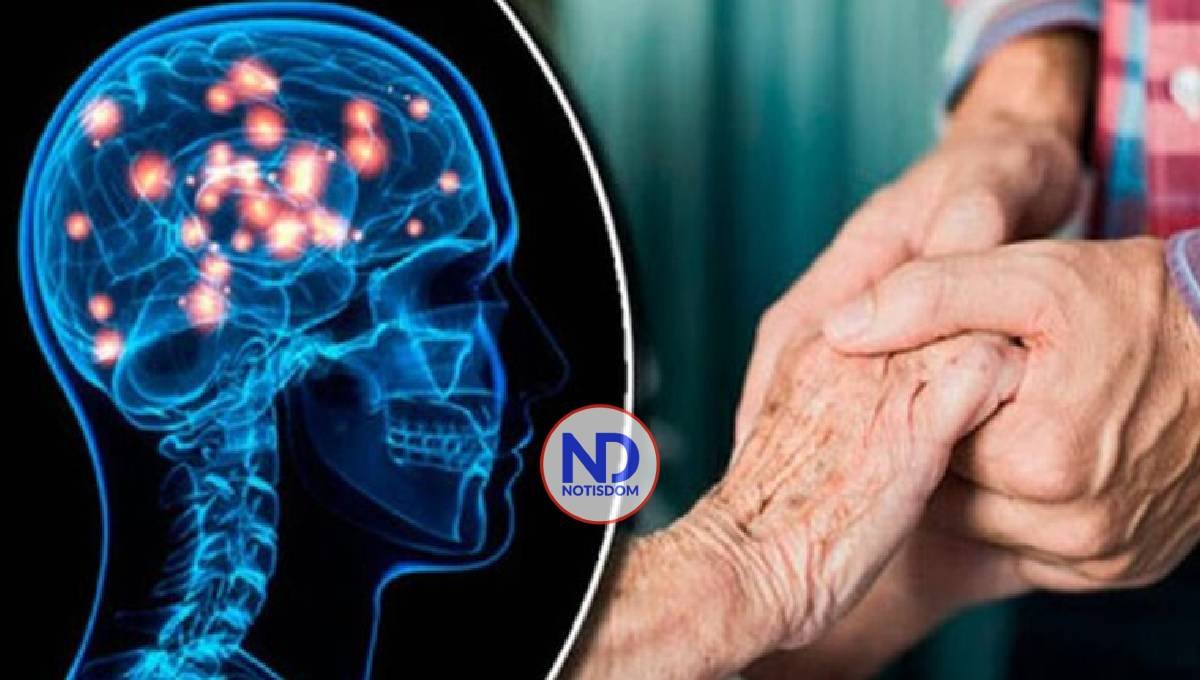 Huntington: Una patología neurodegenerativa y hereditaria catalogada como «rara» 2 Huntington: Una patología neurodegenerativa y hereditaria catalogada como «rara»