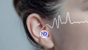 La conmoción cerebral puede tener efectos duraderos en la salud auditiva