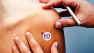 VPH una de las infecciones de transmisión sexual más comunes