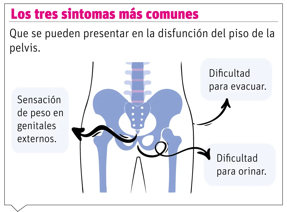 disfuncion del piso pelvico 1 Ginecólogo afirma el 50 % de mujeres padecerán disfunción del piso pélvico
