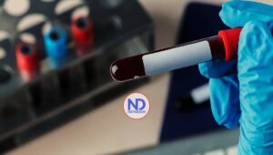 Hemofilia, enfermedad hereditaria que dificulta la coagulación de la sangre