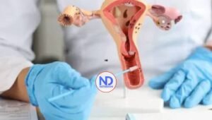 ¿En qué consiste la histerectomía?