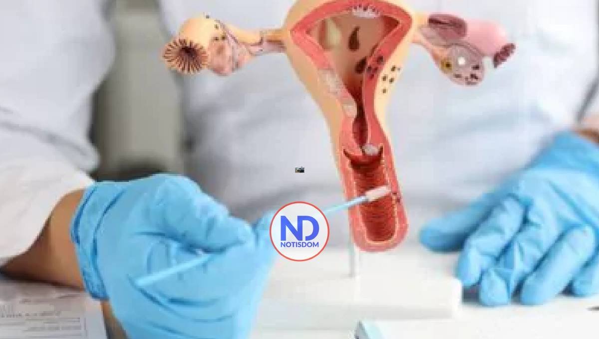 ¿En qué consiste la histerectomía?