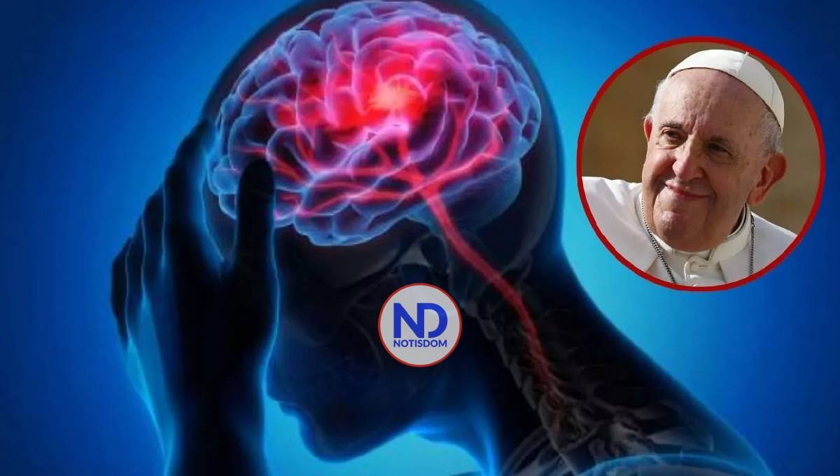 Lo que debes saber sobre el ictus cerebral, la causa de muerte del papa Francisco