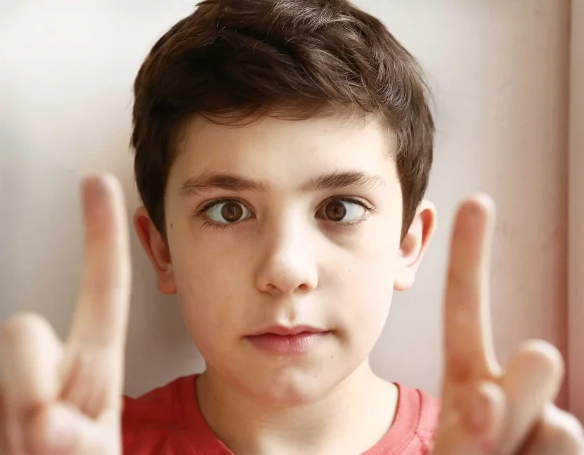 Estrabismo 2 Impacto del estrabismo en la calidad de vida del niño