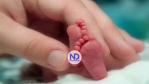 Un estudio vincula nacer prematuro con más opciones de tener problemas de atención