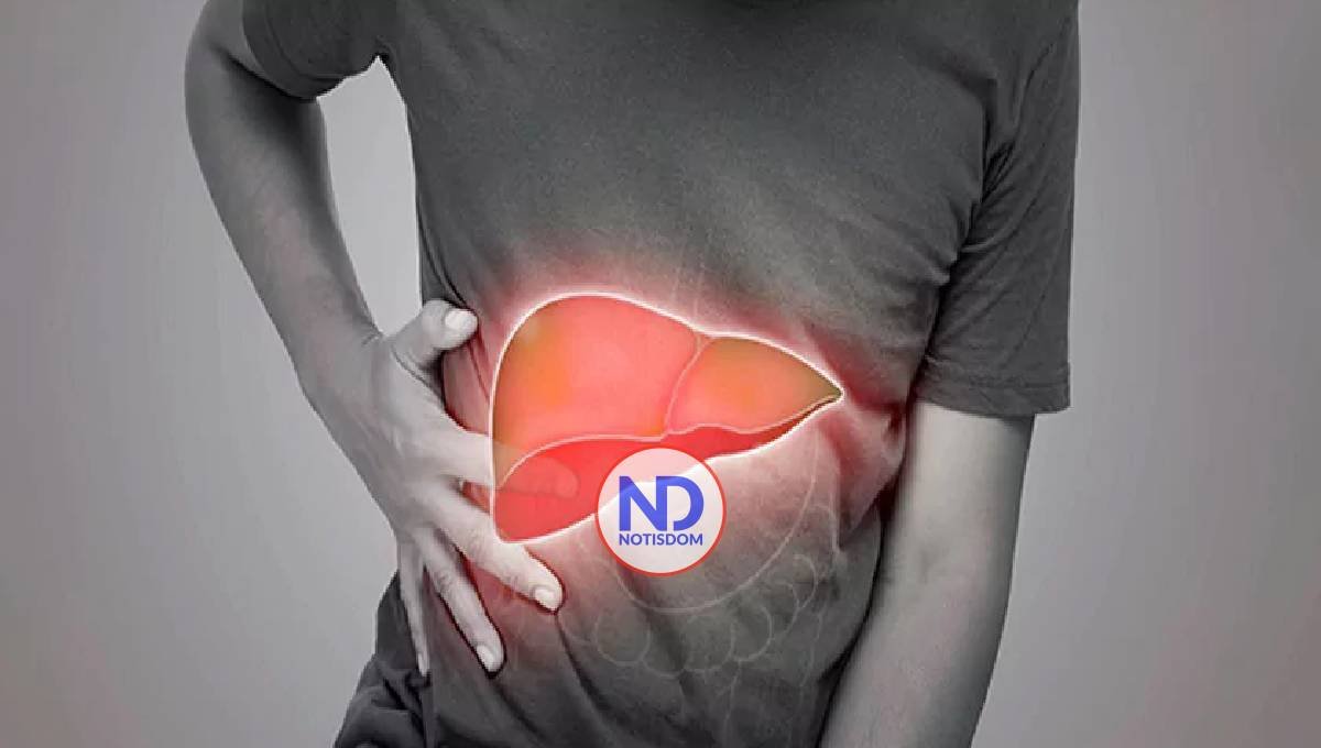 Cómo saber si tengo hígado graso y qué cambios en la alimentación recomiendan los expertos