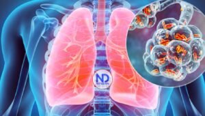 Brote de enfermedad del legionario deja un muerto y 22 infectados en Harlem