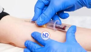 Identifican 250 proteínas en sangre que pueden revelar la gravedad de la malaria