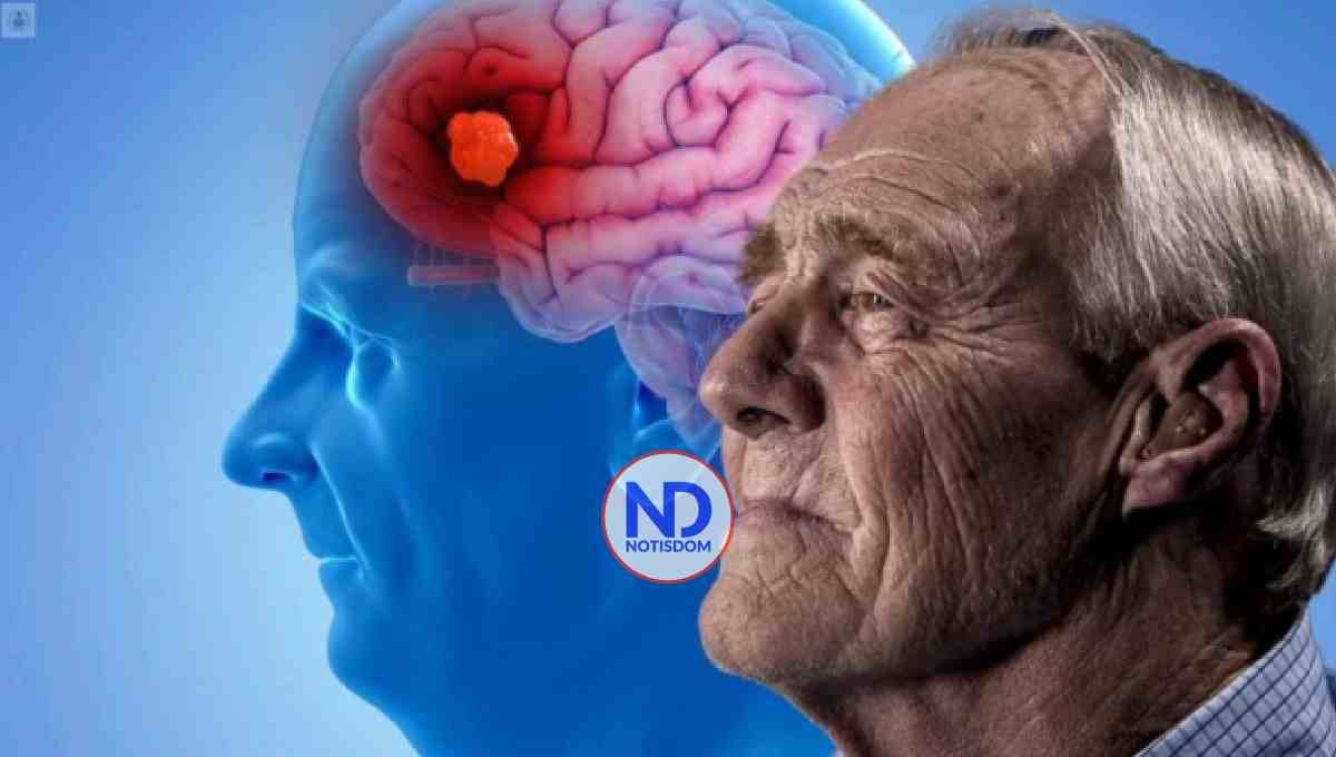 Dominicana: cine y experiencia sensibilizarán sobre Alzheimer 2 Dominicana: cine y experiencia sensibilizarán sobre Alzheimer