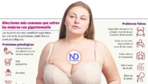 Gigantomastia, condición que afecta salud física y emocional de la mujer