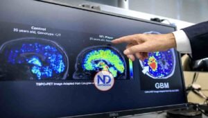 Prueban la eficacia de un análisis de sangre para detectar el alzhéimer en fases tempranas