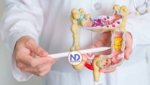 ¿Cómo produce popó tu cuerpo?