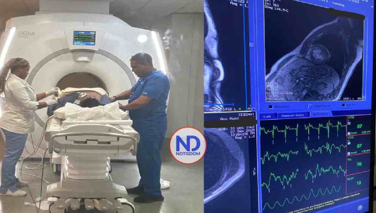 Realizan primera resonancia cardíaca de estrés en la RD