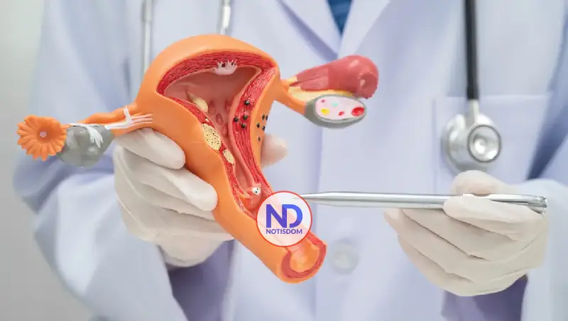 Esterilización quirúrgica: ¿una decisión definitiva que requiere reflexión? 2 Esterilización quirúrgica: ¿una decisión definitiva que requiere reflexión?