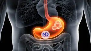 Siete de cada diez mexicanos tienen la bacteria vinculada al cáncer gástrico