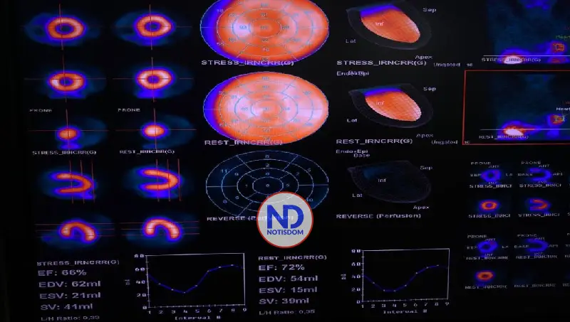 CEDIMAT realiza gammagrafía cardíaca con Regadenoson