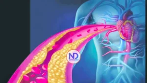 Científicos explican por qué los infartos son menos graves por la noche