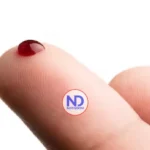 Una gota de sangre de la yema del dedo podría servir para detectar el alzhéimer