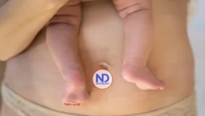 La cirugía plástica postparto: cuándo es recomendable