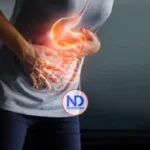 Reflujo Gastroesofágico es motivo frecuente para consultas de gastroenterólogos