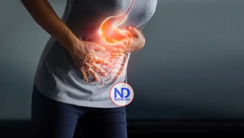 Reflujo Gastroesofágico es motivo frecuente para consultas de gastroenterólogos