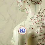 Acupuntura para el colesterol alto: ¿qué dice la ciencia sobre los puntos de la medicina tradicional china?