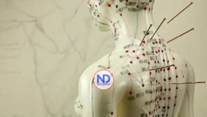 Acupuntura para el colesterol alto: ¿qué dice la ciencia sobre los puntos de la medicina tradicional china?