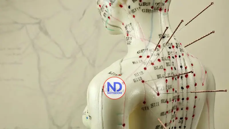 Acupuntura para el colesterol alto: ¿qué dice la ciencia sobre los puntos de la medicina tradicional china?