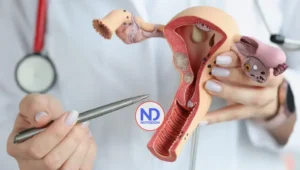 Identifican un marcador que predice la recaída en el cáncer de endometrio más común