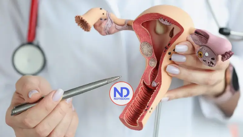 Identifican un marcador que predice la recaída en el cáncer de endometrio más común