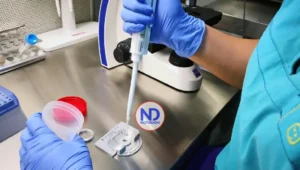 Detectan el primer caso de transmisión de una enfermedad rara mediante donante de esperma