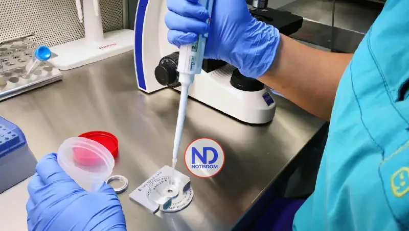 Detectan el primer caso de transmisión de una enfermedad rara mediante donante de esperma