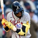 Ronald Acuña otra vez a la lista de lesionados