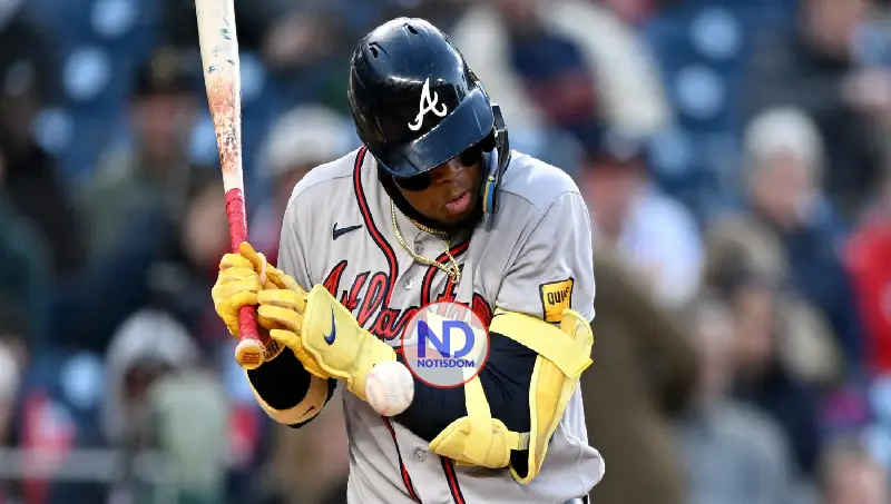 Ronald Acuña otra vez a la lista de lesionados