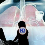 Un estudio internacional valida dos algoritmos para predecir el riesgo cardiovascular