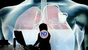 Un estudio internacional valida dos algoritmos para predecir el riesgo cardiovascular