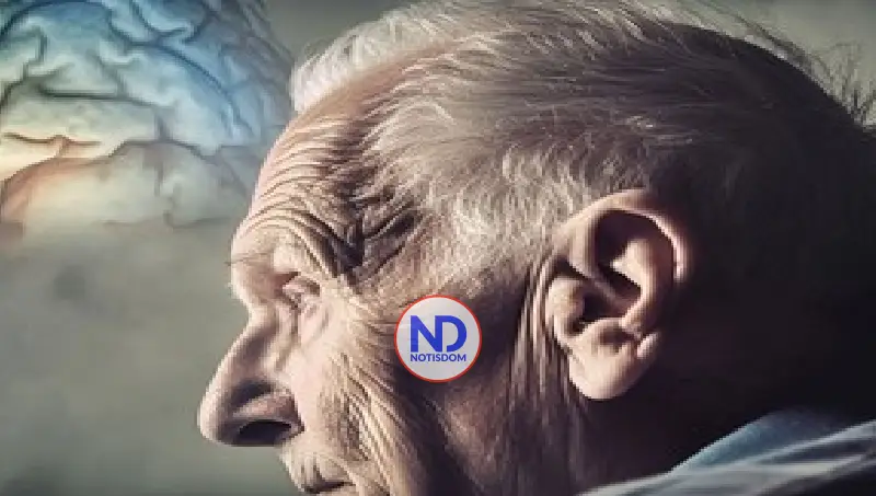 ¿Cuándo comienza realmente el Alzheimer? 2 ¿Cuándo comienza realmente el Alzheimer?