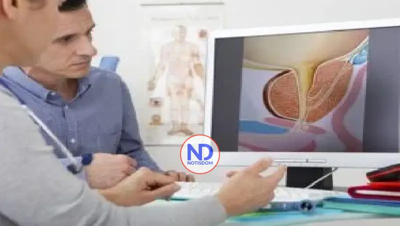 Cáncer próstata conmemora su día con altas tasas curaciones 2 Cáncer próstata conmemora su día con altas tasas curaciones
