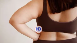 «La obesidad genera más de 200 complicaciones asociadas», advierte especialista