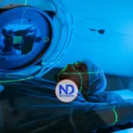 Radioterapia en 2026, menos miedo, más precisión